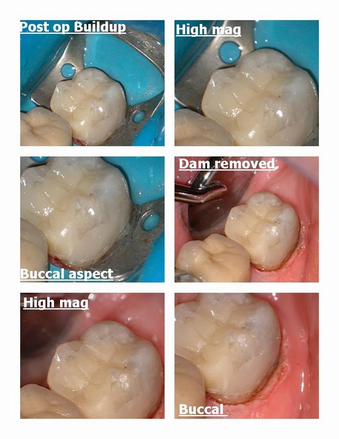 Resize of 2 laser case pg 3.jpg